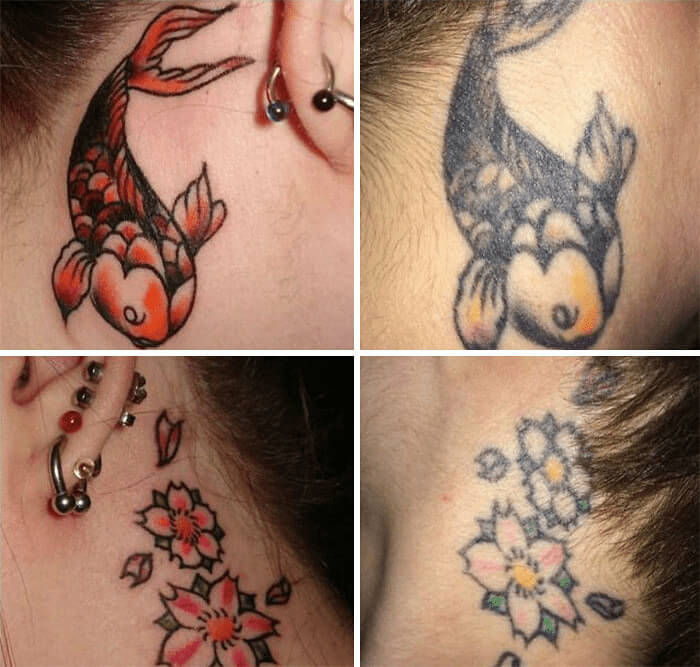 Before And After Photos Of Matching Tattoos