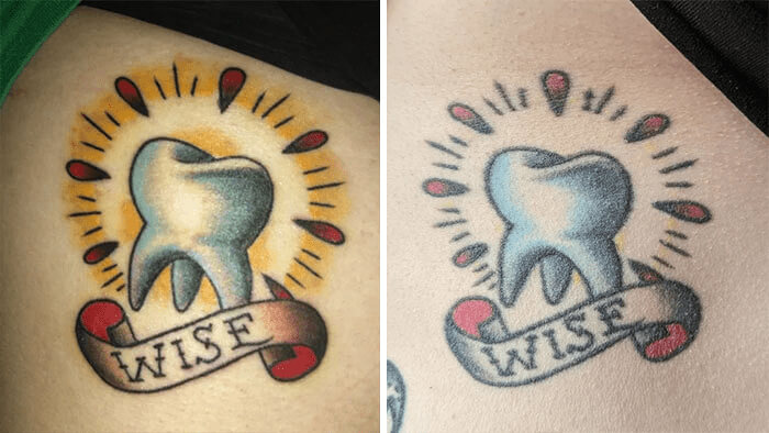 A Classic Wisdom Tooth Tattoo