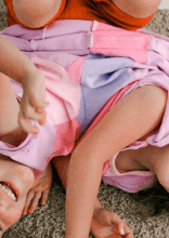 قصة التوأم الملتصق كندرا وماليا اللتين فصلتا بعملية معقدة وعاشتا حياة سعيدة