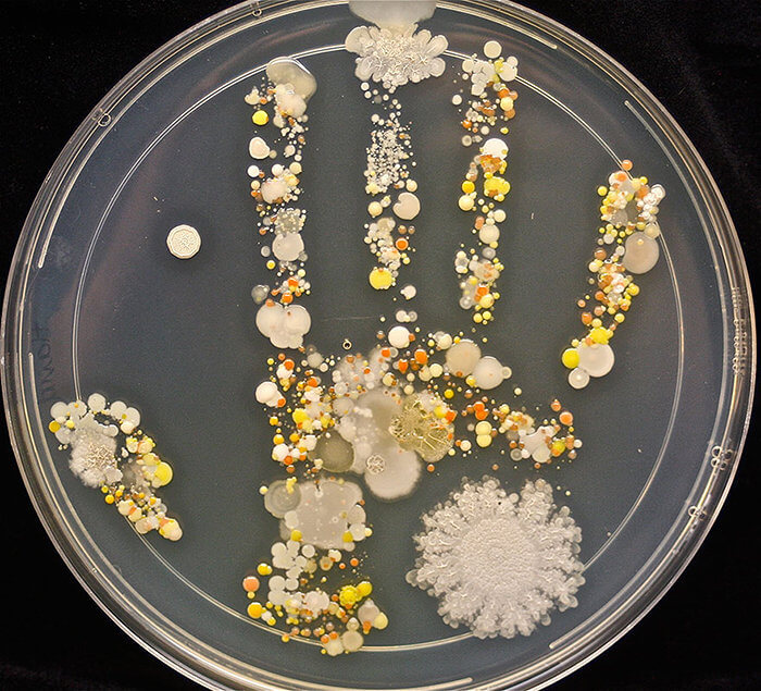 What Happens When a Little Boy Puts His Hand in a Petri Dish?