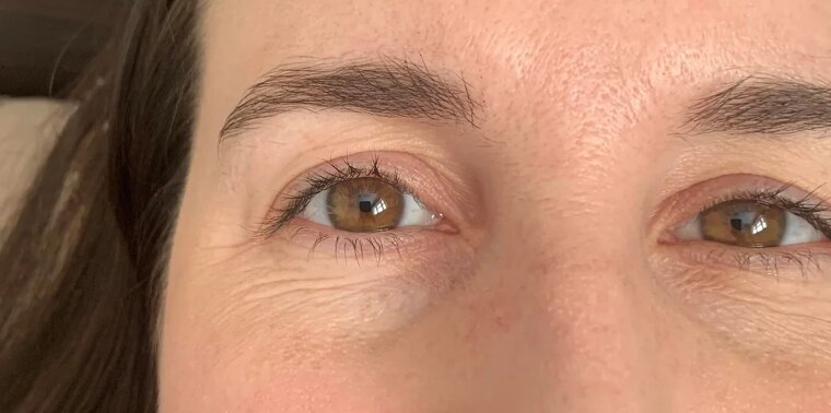 Aging Is a Privilege, Not a Curse