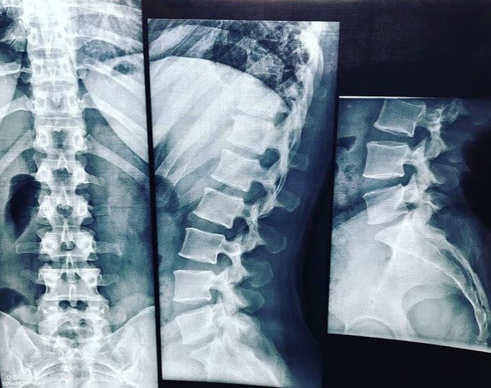 A mãe deixou que pensasse o pior