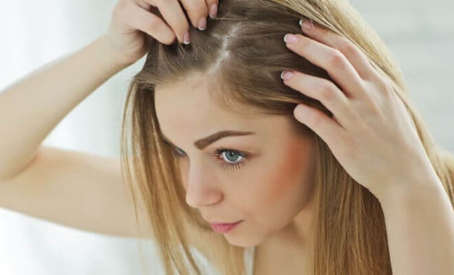 7 Sneaky Reasons for Hair Loss