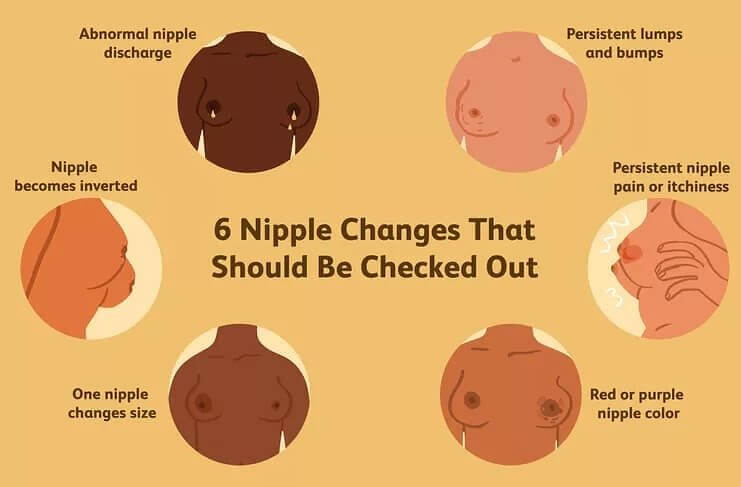 Women's Breast Can Change but Lookout for These Warning Signs