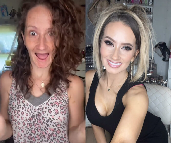 Pregnancy Can Make You Lose Your Teeth