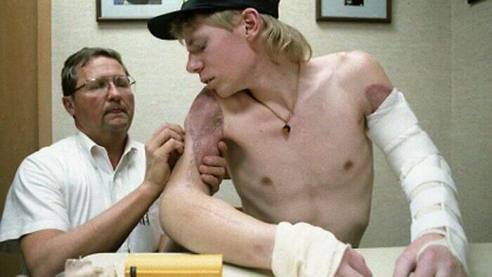 Both His Arms Were Ripped Off In An Accident And Doctors Reattached Them