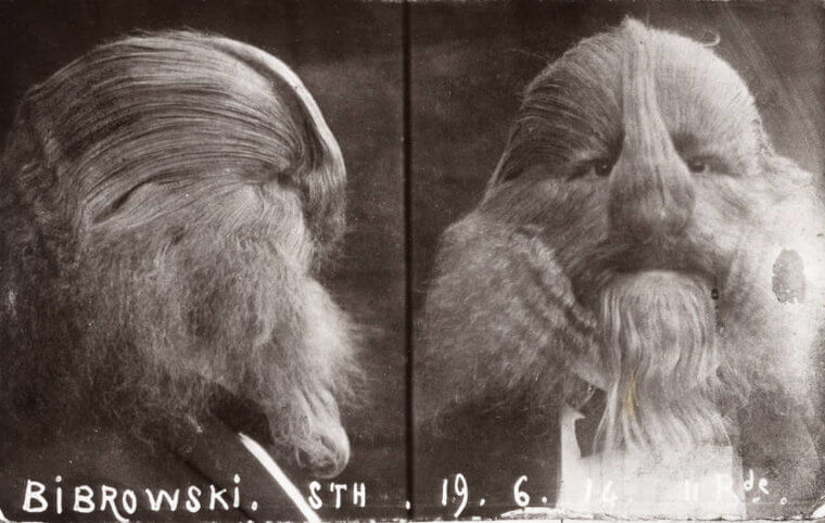 Lionel the Lion-Faced Man