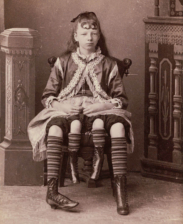 The Four-Legged Girl From Texas