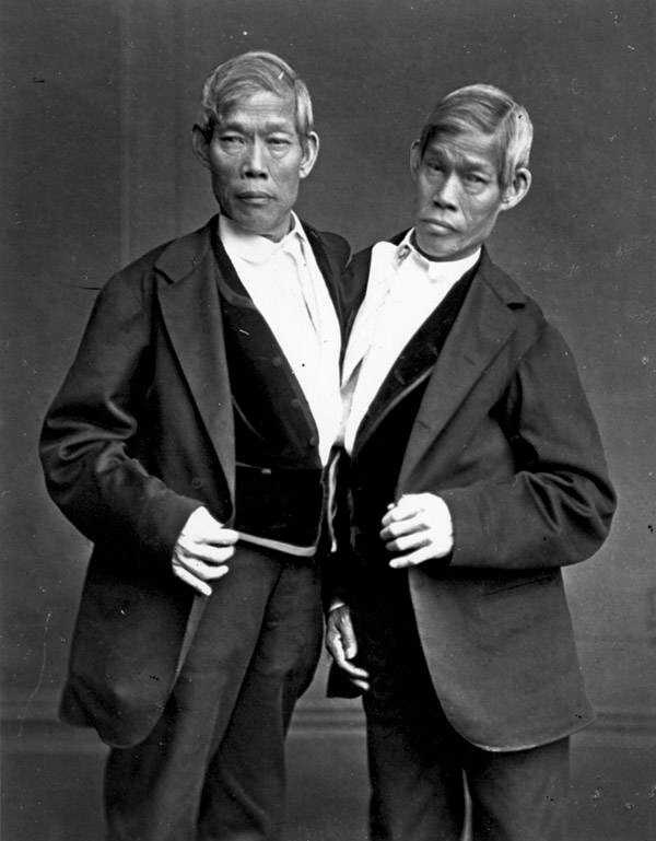 Chang and Eng: The Original Siamese Twins