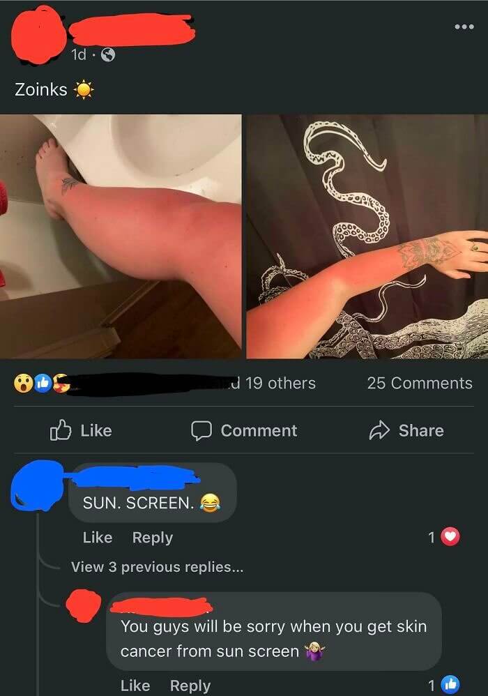 This Lady Who Wears Her Sunburn Like a Badge of Honor