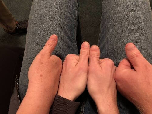 Diese Person hat von jedem Elternteil einen Daumen geerbt