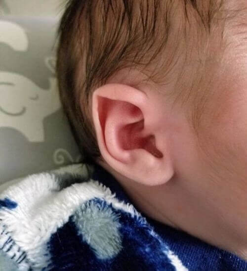 Baby mit Elfenohren