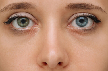 People With Unique Genetic Traits That Show How Unpredictable Nature Can Be