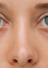 Pessoas com características genéticas únicas que mostram como a natureza pode ser imprevisível