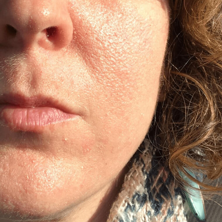 Stay Away From Cleansers With Microbeads