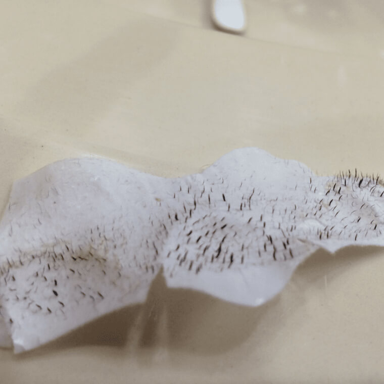 Nose Strips Can Actually Harm Your Pores