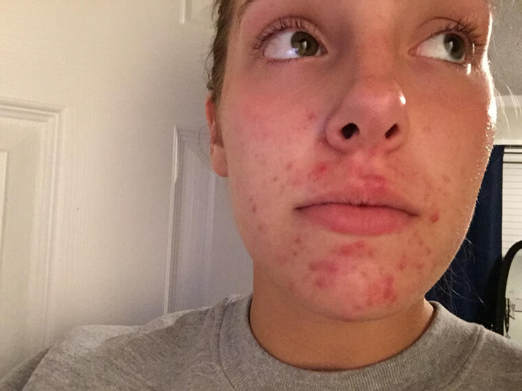 Don't Overload Your Skin With Dozens of Different Products