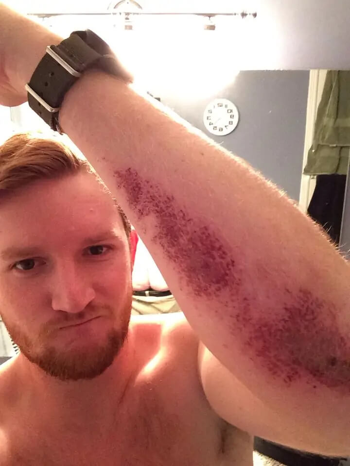 A Lot More Than Road Rash