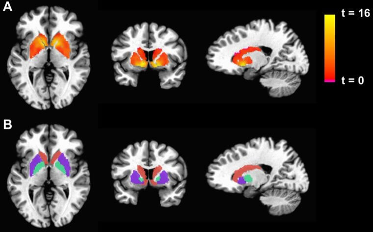 Il existe un lien génétique entre la couleur des yeux et la personnalité