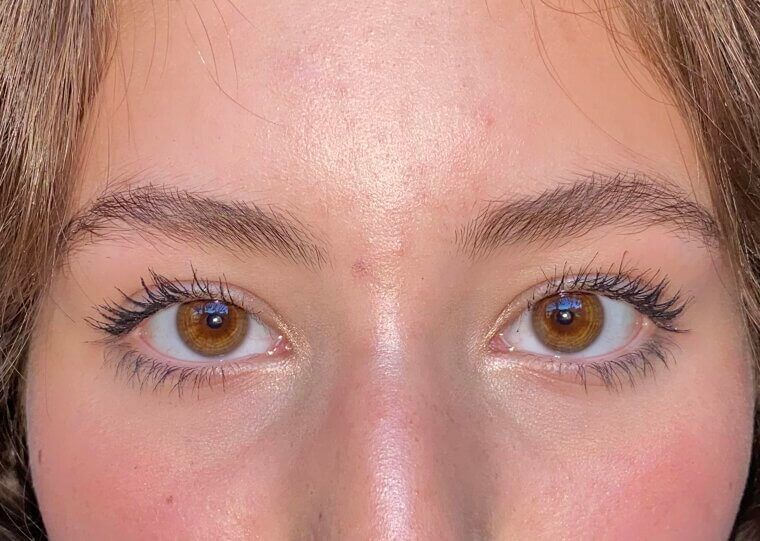 Crossed Eyes Forever