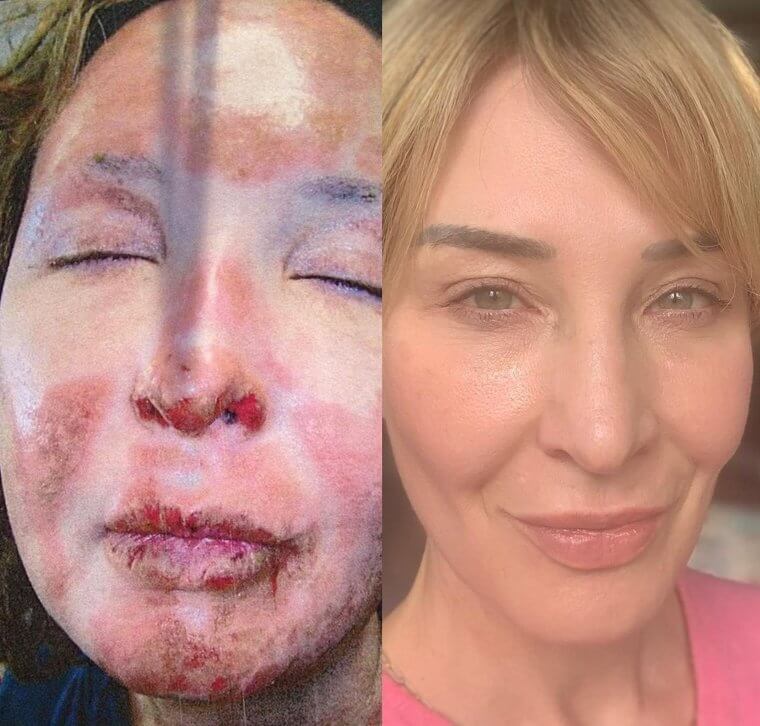 Foreskin: The Holy Grail