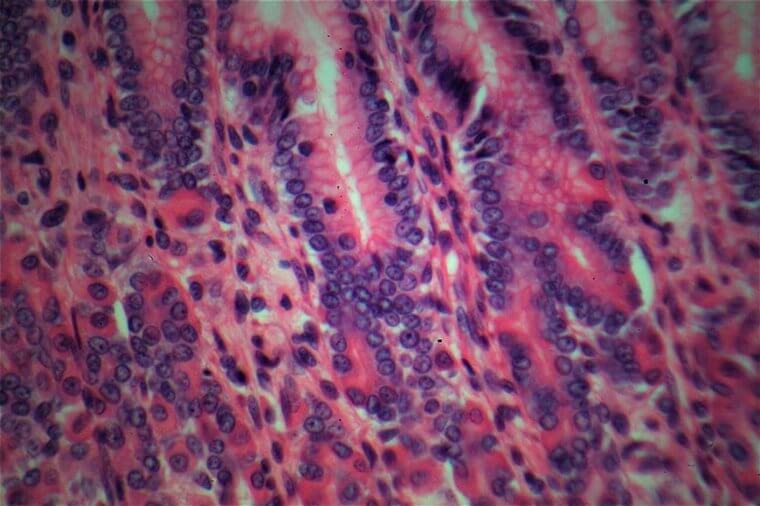 Stomach Lining Cells - The Sequel