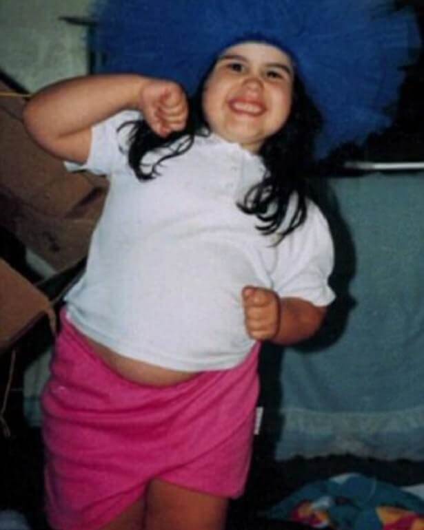 Weight Problems Since Childhood