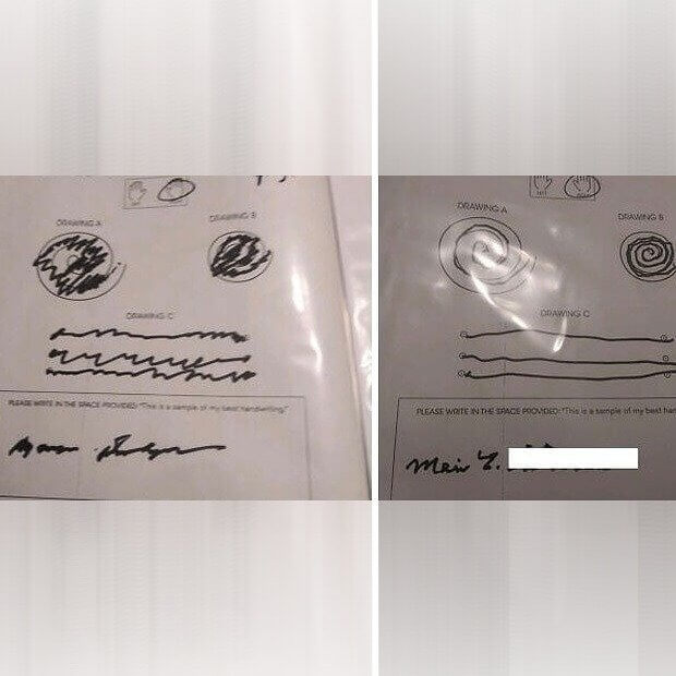 Het handschrift van een 90-jarige oma voor en na de behandeling van tremor