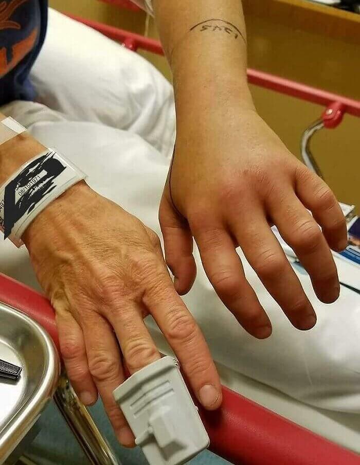 Dezelfde persoon maar met één hand gebeten door ratelslang