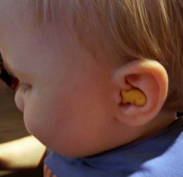 The Way This Fish Sits in This Child's Ear (gross)
