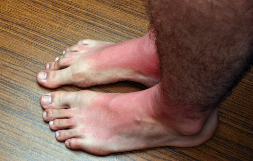 When You Forget Your Socks In The Sahara