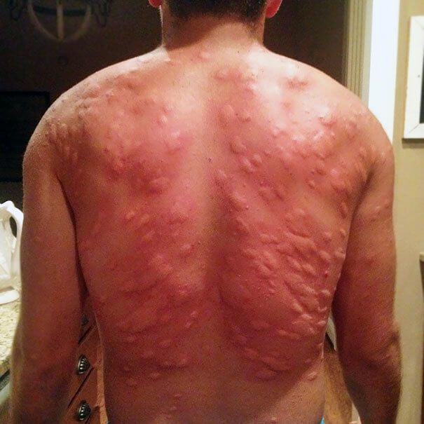 A Few Bumps But We Got Back Okay