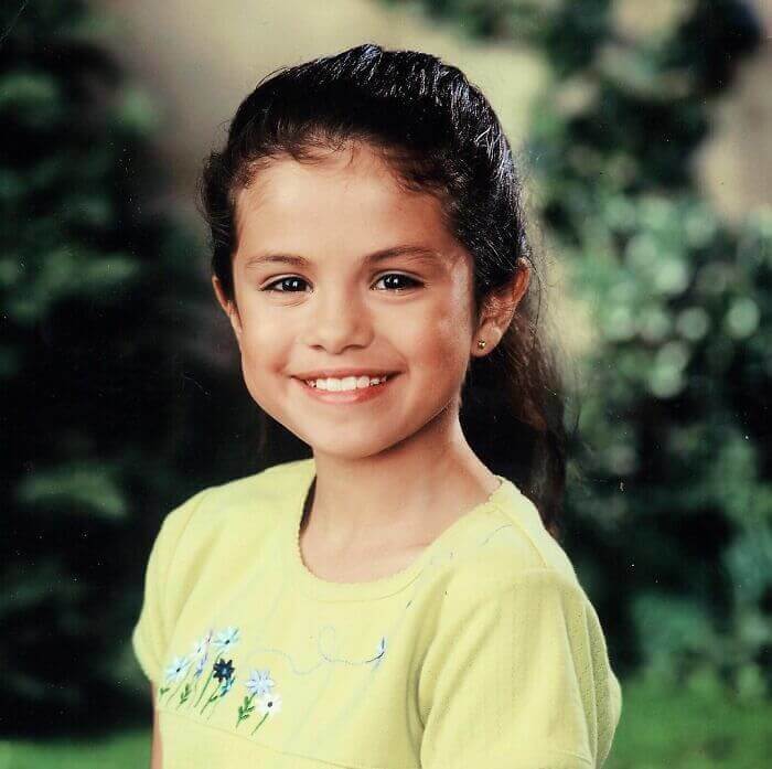 Selena Gomez's Face Has Not Changed
