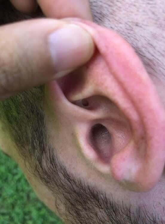 Допълнителна дупка в ухото му