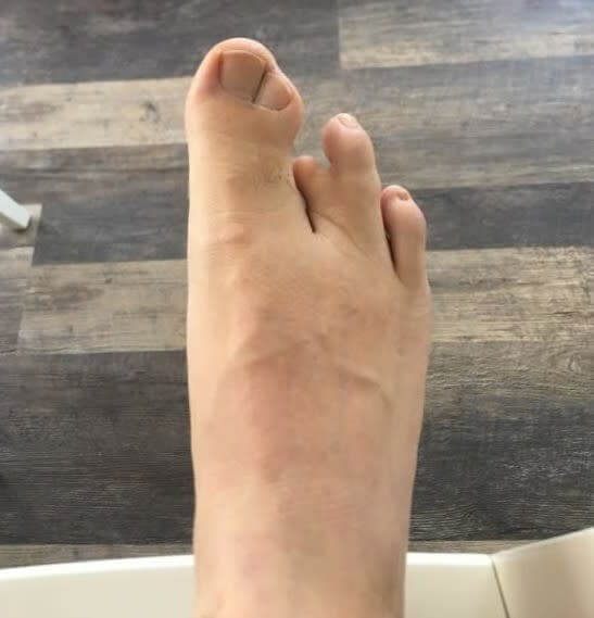 Три пръста на краката