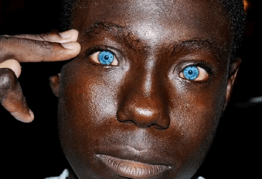 أشخاص محظوظون ورثوا جينات نادرة جعلتهم مميزين وسط الجميع