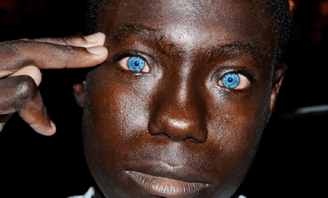 30+ Menschen mit seltenen Genen, die sie einzigartig machen