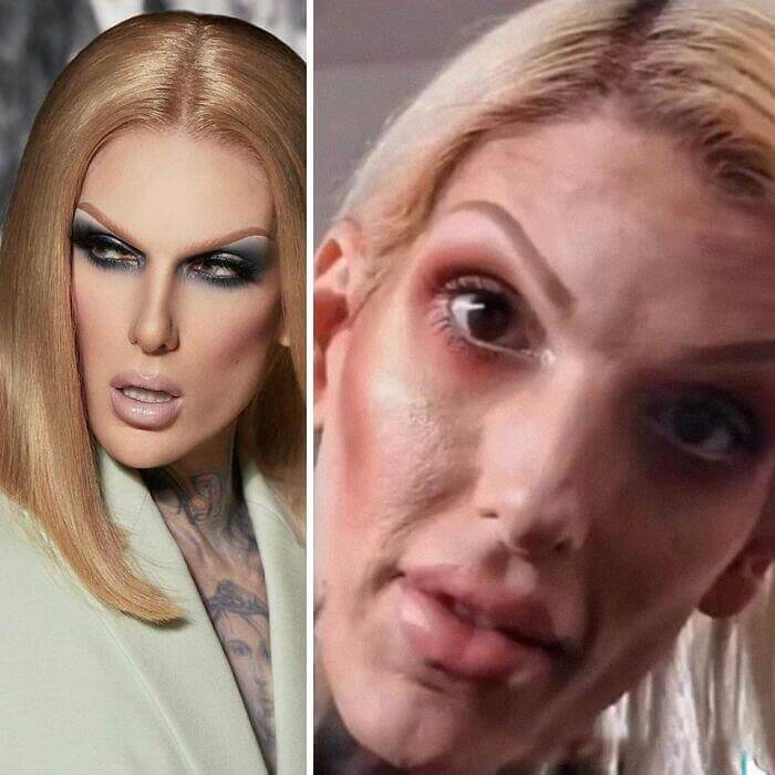 He's Famous, But His Fans Had No Idea He Looked Like This