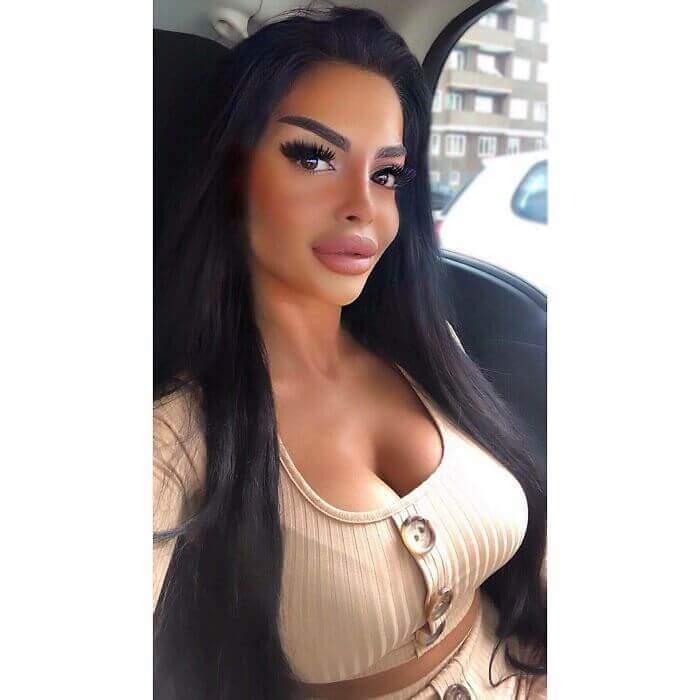 Let's Be Honest, Not Even Fillers Explain This One