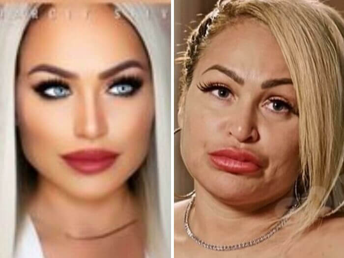 The Quick, Affordable Way To Avoid Botox