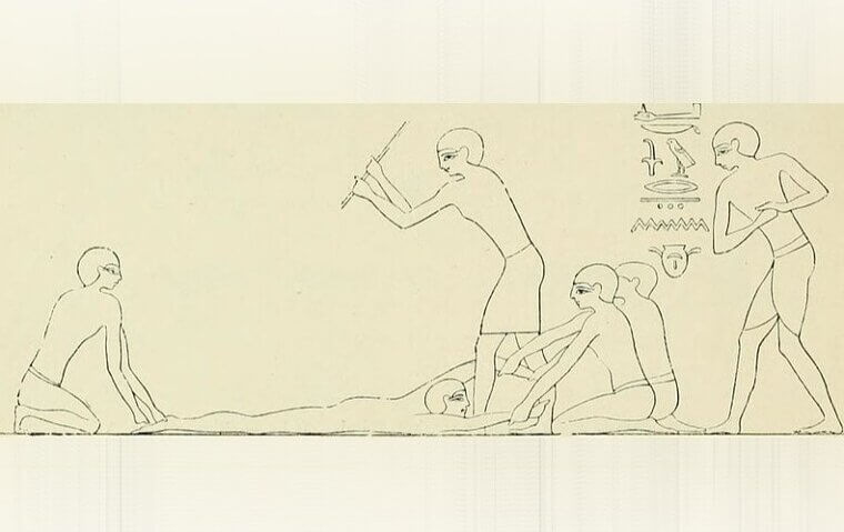 Organs Were Altered During Burial