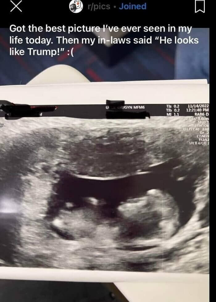 When the Ultrasound Looks Like Trump
