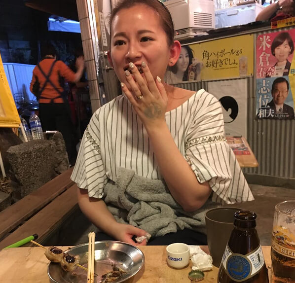 Rinfrescatevi In Un Attimo Dopo Esservi Scottati Col Cibo