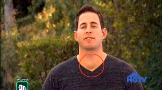 Out Of Millions Of Viewers, One Spotted A Mysterious Lump On This HGTV Star