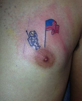 First Landing on the Nipple