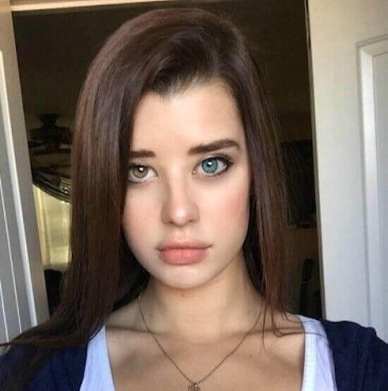 2色の目を持つ人がいるのは稀なケースです。