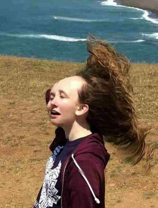 Talk About a Receding Hairline