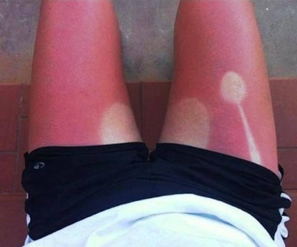 No More Eating Outside For You