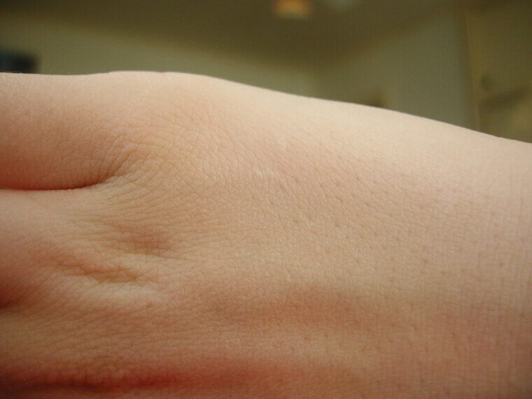 Some Signs Show on the Outside