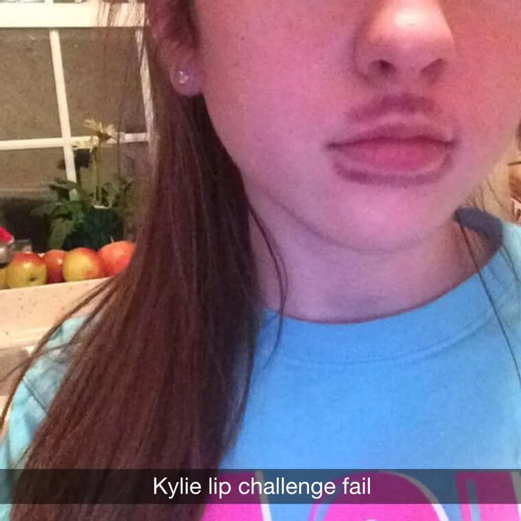 Lip Challenge Fail